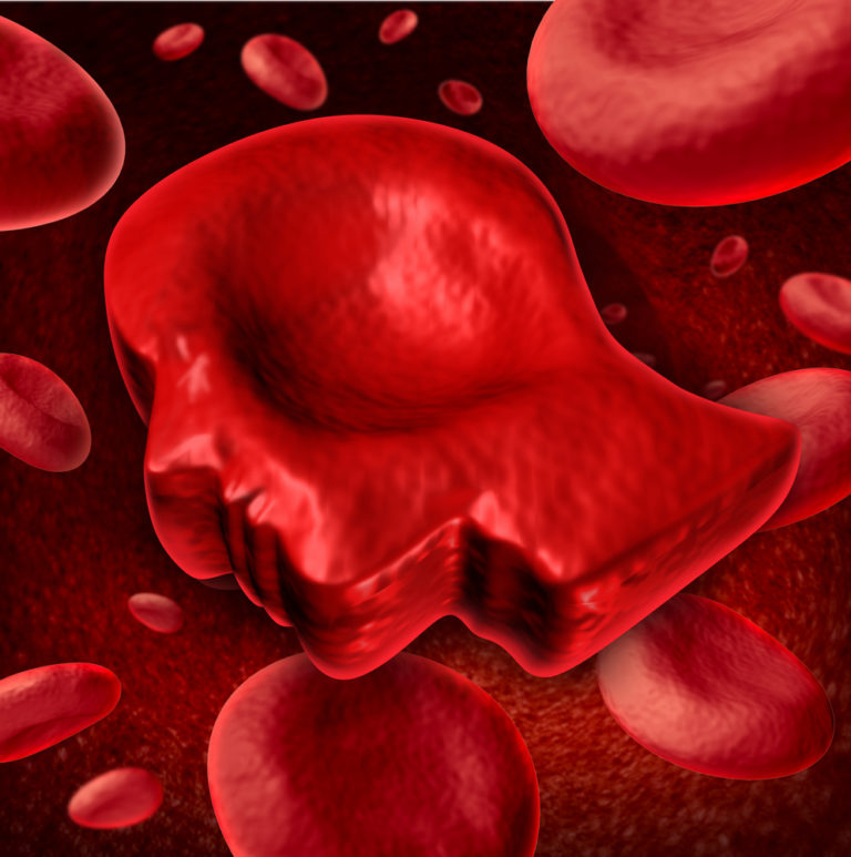 Ομάδα αίματος: επηρεάζει τη μνήμη; | vita.gr