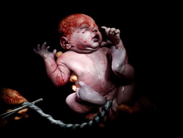 Μωρά την ώρα της γέννας | vita.gr