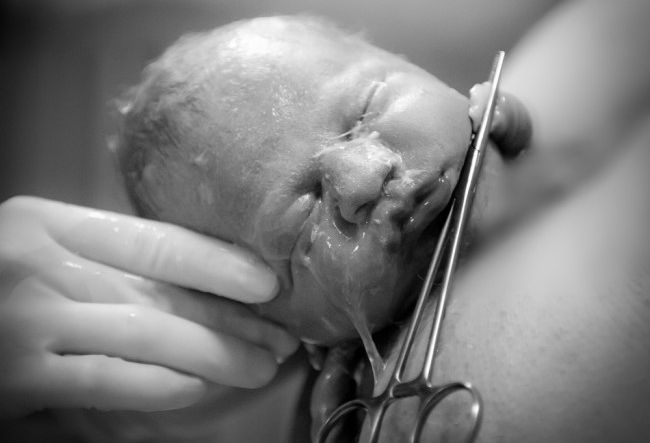Εικόνες: Η στιγμή της γέννας που βγαίνει το κεφαλάκι του μωρού