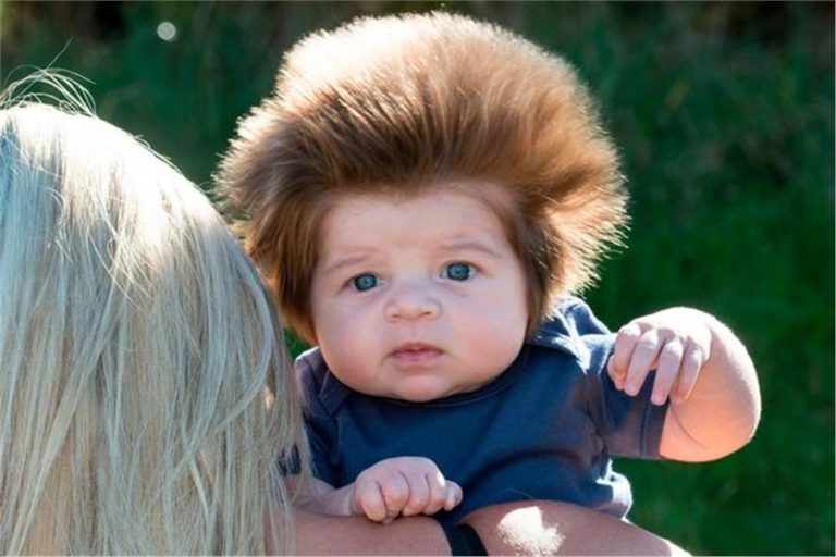 Εικόνες: Tο μωρό που έγινε viral εξαιτίας των… μαλλιών του | vita.gr