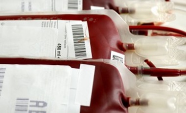 Βιομηχανικό αίμα για μεταγγίσεις | vita.gr