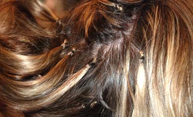Αλωπεκία από extensions η Ναόμι Κάμπελ; | vita.gr Αλωπεκία από extensions η Ναόμι Κάμπελ; | vita.gr