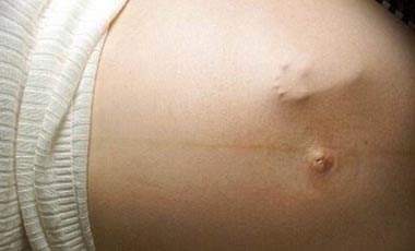 Εγκυμονούσες: Προσοχή στις κονσέρβες | vita.gr