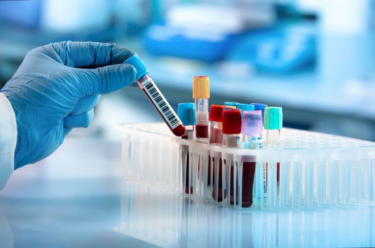 «Υγρές βιοψίες»: Εντοπισμός όγκων μέσω αιματολογικής εξέτασης | vita.gr