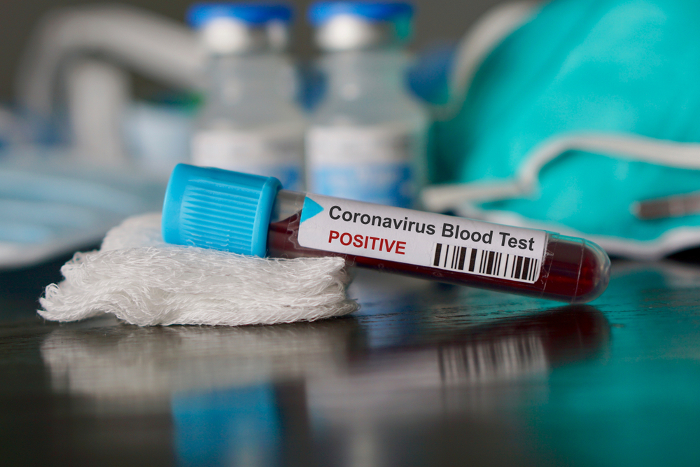 Κοροναϊός : Ποιες ομάδες αίματος κινδυνεύουν περισσότερο και ποιες λιγότερο