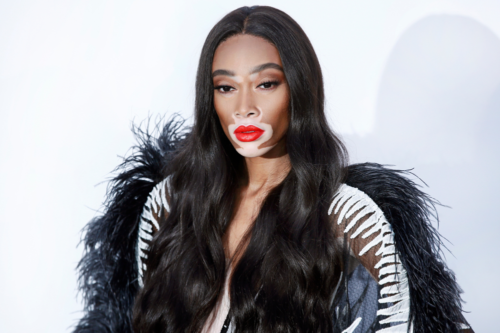 Winnie Harlow: Αποχωρίστηκε τα μακριά της μαλλιά για ένα τολμηρό pixie cut