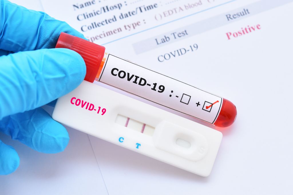 COVID: Σχεδόν 5.000 νέα κρούσματα και 500 επαναλοιμώξεις