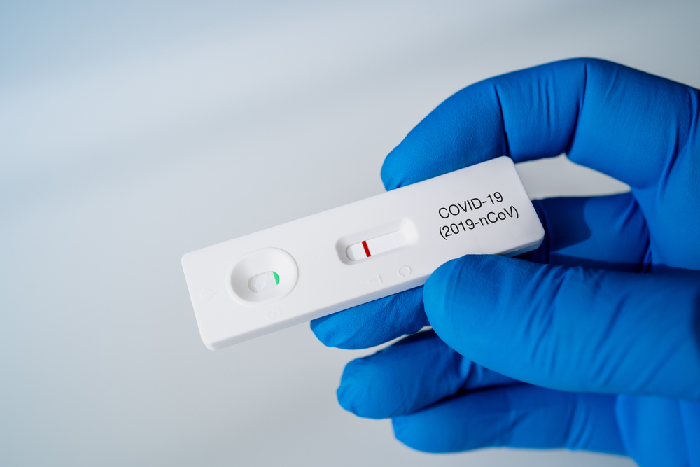 ΕΟΔΥ - Πού μπορείτε να κάνετε δωρεάν rapid test για κορωνοϊό