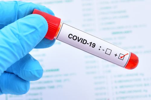 Covid-19: Ανθρώπινα γονίδια μας προφυλάσσουν από τον κοροναϊό