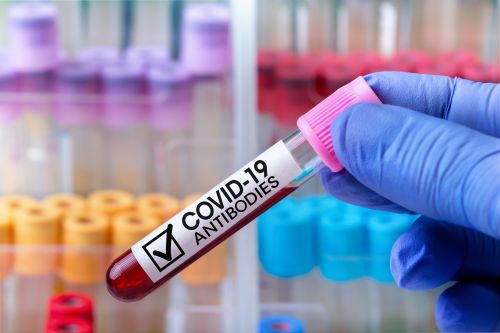 Κορωνοϊός: Νέο τεστ αντισωμάτων ούρων και όχι αίματος
