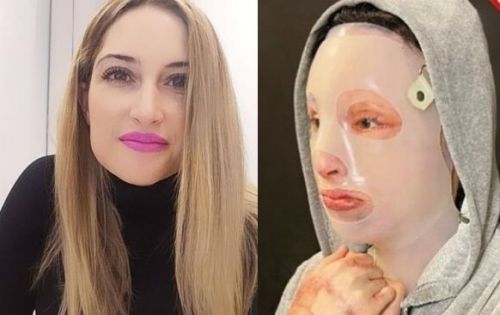 Βιτριόλι – Με ειδική μάσκα η Ιωάννα στο δικαστήριο