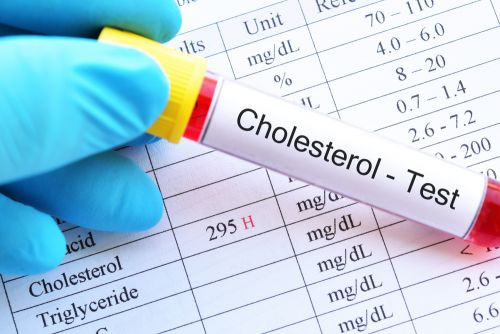 Χοληστερίνη: Πώς μπορούμε να την ελέγξουμε;