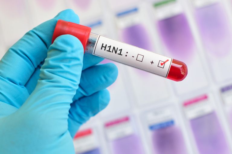 H1N1: «Απόγονος» της ισπανικής γρίπης – Πώς προκύπτει η σχέση τους | vita.gr