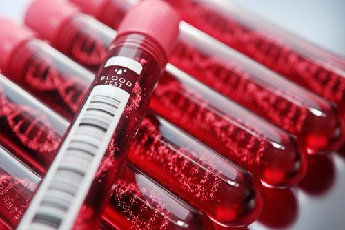 Long covid: Στα σκαριά το πρώτο τεστ αίματος που προβλέπει αν κάποιος κινδυνεύει