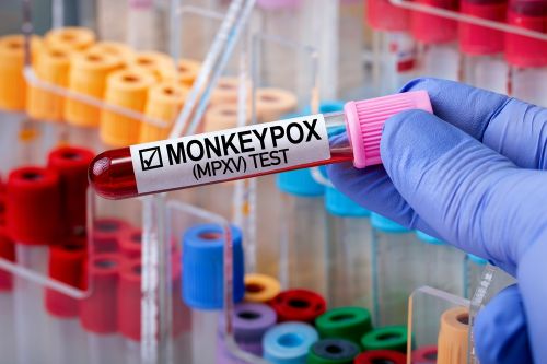 ΠΟΥ: Λήξη συναγερμού για την πανδημία mpox