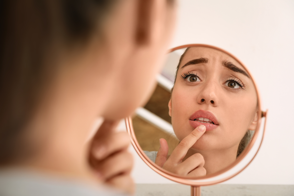 Σκασμένα χείλη: Ποιες οι αιτίες και πώς τα «θεραπεύουμε»;