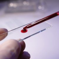 AI: 5 σταγόνες αίμα καθορίζουν την ηλικία μας