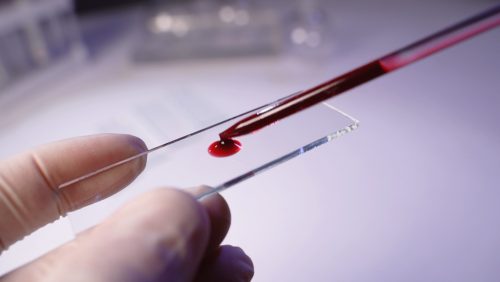 AI: 5 σταγόνες αίμα καθορίζουν την ηλικία μας