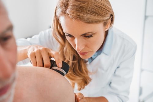 Μελάνωμα: Διπλάσιος ο κίνδυνος με 5+ ηλιακά εγκαύματα