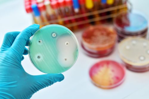 Κάποιες από τις μεγαλύτερες εφευρέσεις ήρθαν… τυχαία