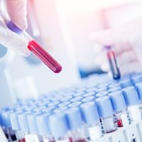 Έρευνα: Μαθαίνουμε για τη «μάχη» με τους ιούς με 1 σταγόνα αίμα