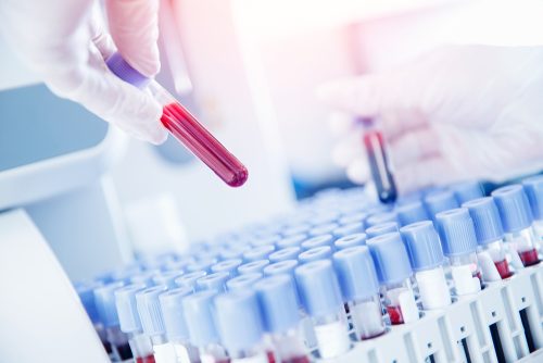 Έρευνα: Μαθαίνουμε για τη «μάχη» με τους ιούς με 1 σταγόνα αίμα