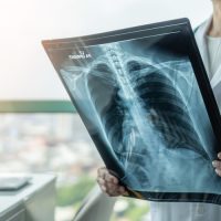 AI: Εντοπίζει όγκους στον πνεύμονα, όσο αυτοί… κινούνται