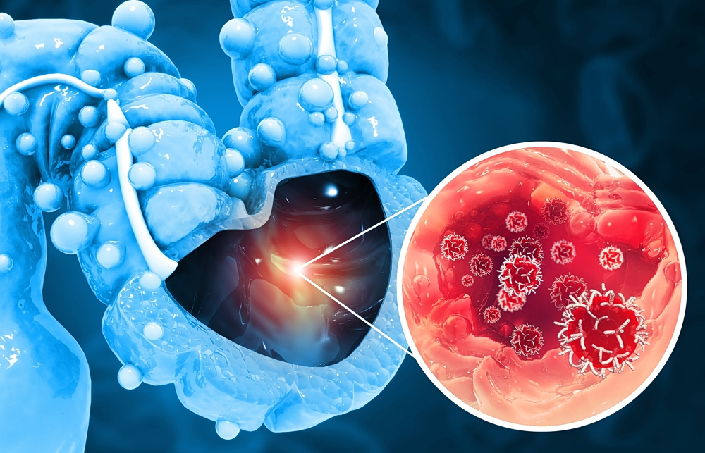 Άλυτο ιατρικό μυστήριο: Ο καρκίνος που χτυπάει τη γενιά του ’90