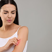 Ατοπική δερματίτιδα: Λιγότερο άγχος, λιγότερες εξάρσεις;