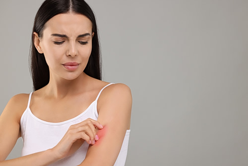 Ατοπική δερματίτιδα: Λιγότερο άγχος, λιγότερες εξάρσεις;