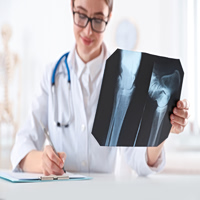 Οστά: Τα υπερεπεξεργασμένα τρόφιμα είναι «εχθρός» τους