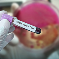Έμπολα: 671 τα κρούσματα και 160 οι θάνατοι – Η ανησυχία των υγειονομικών αρχών