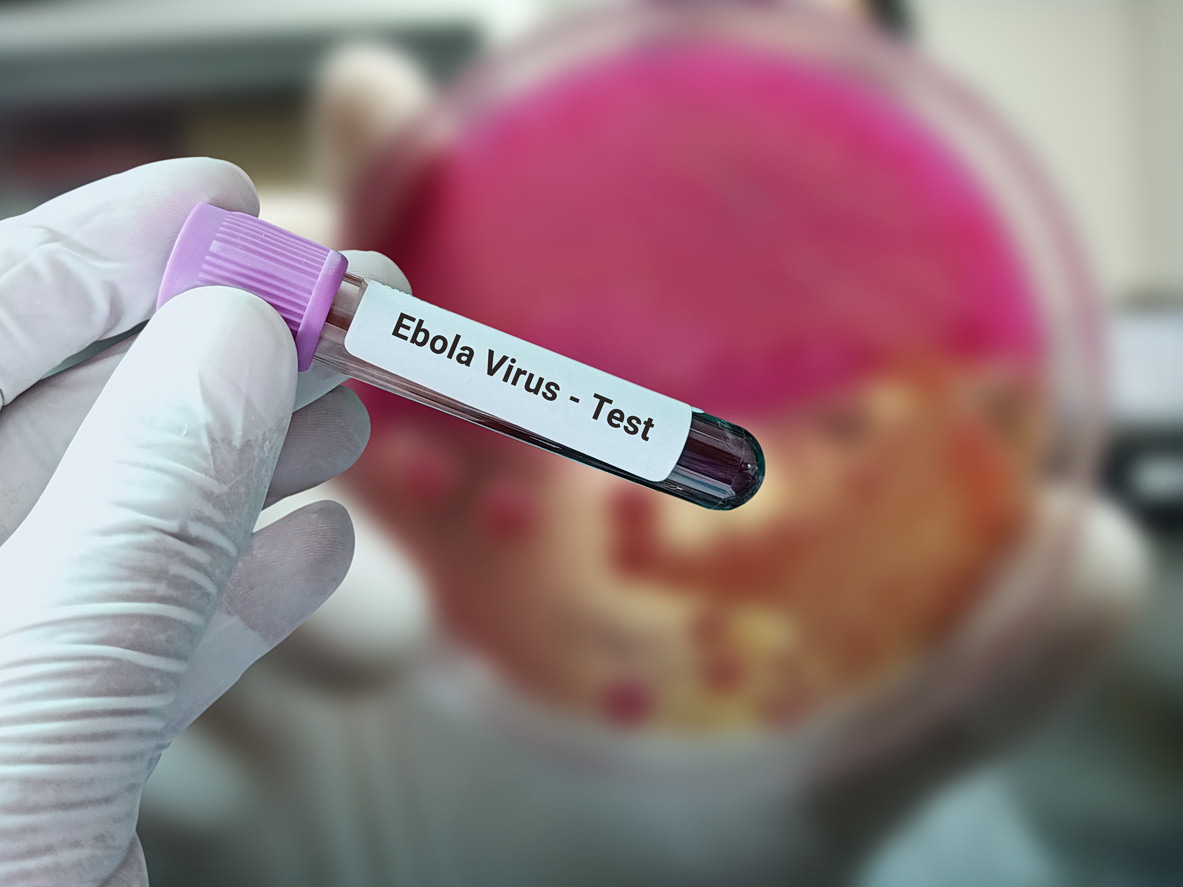 Έμπολα: 671 τα κρούσματα και 160 οι θάνατοι – Η ανησυχία των υγειονομικών αρχών