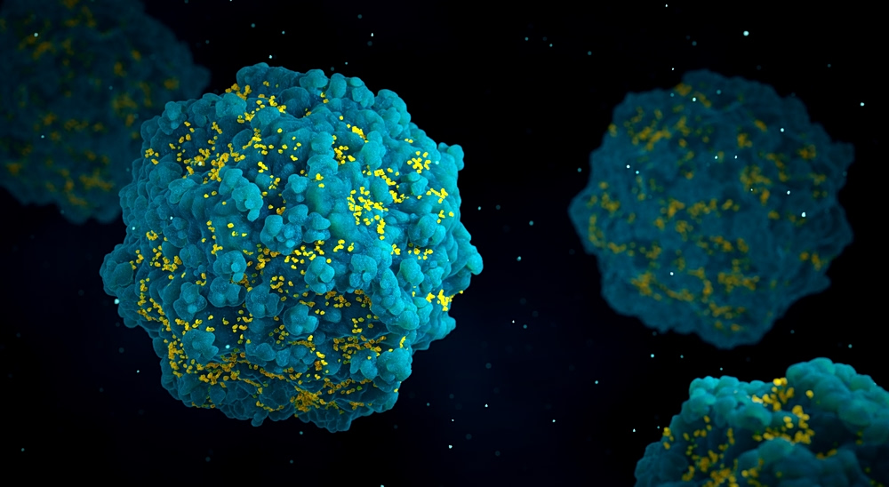 HIV: Μόνιμη αντιμετώπιση υπόσχεται κυτταρική θεραπεία