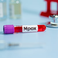 Ήπειρος: Πρώτο κρούσμα ευλογιάς των πιθήκων (mpox)