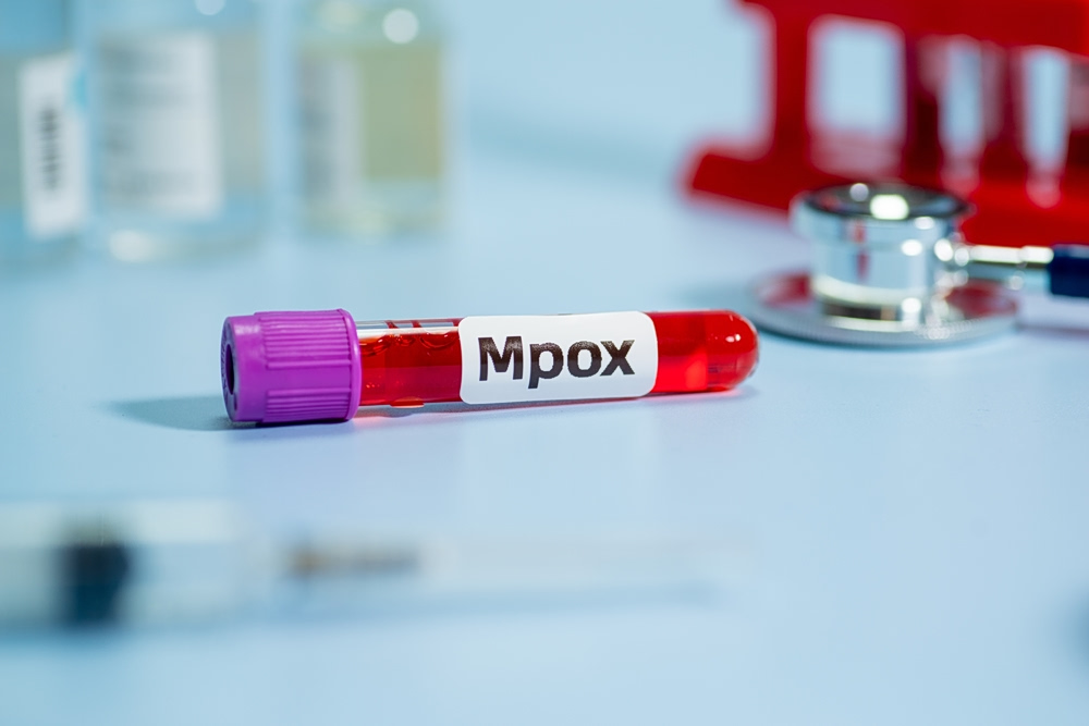 Ήπειρος: Πρώτο κρούσμα ευλογιάς των πιθήκων (mpox)